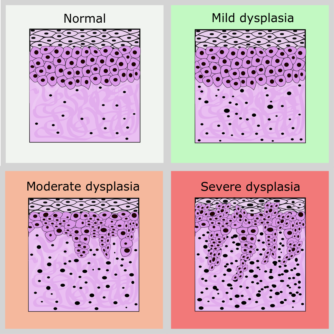 crypto dysplasia