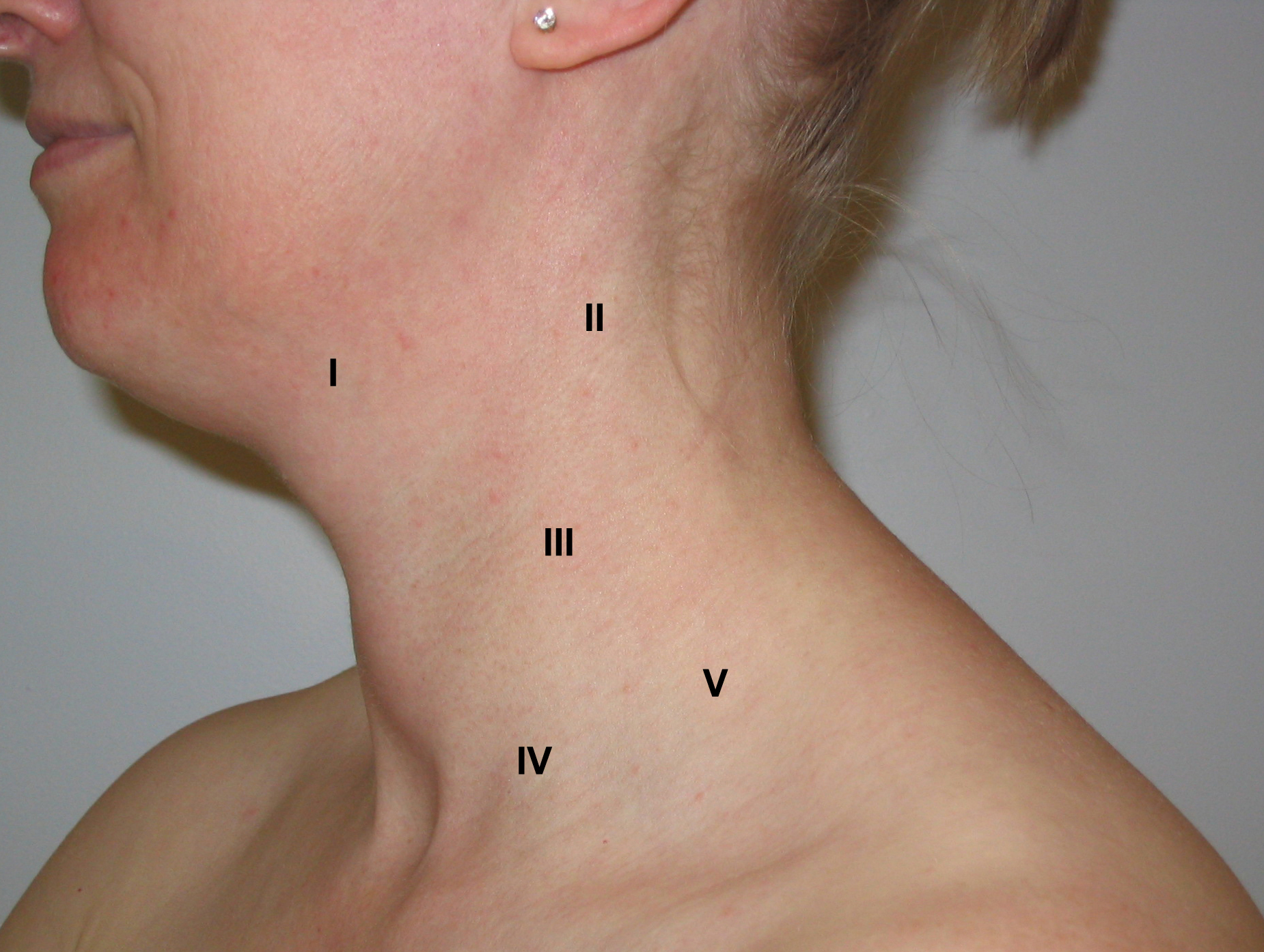 location lymph nodes in neck